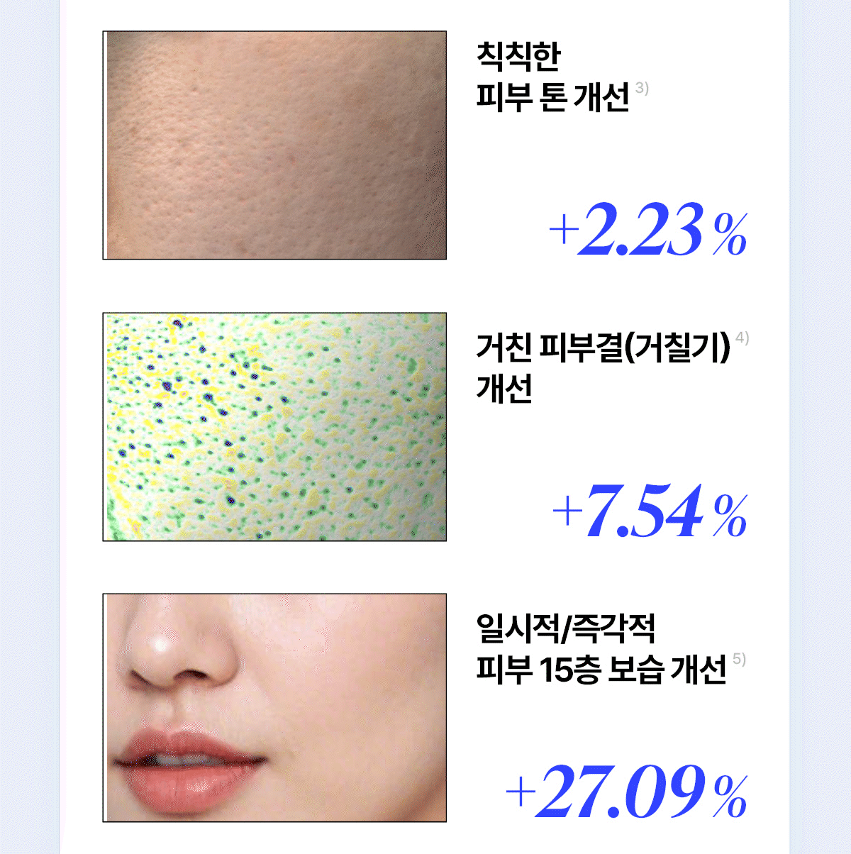 It'S SKIN